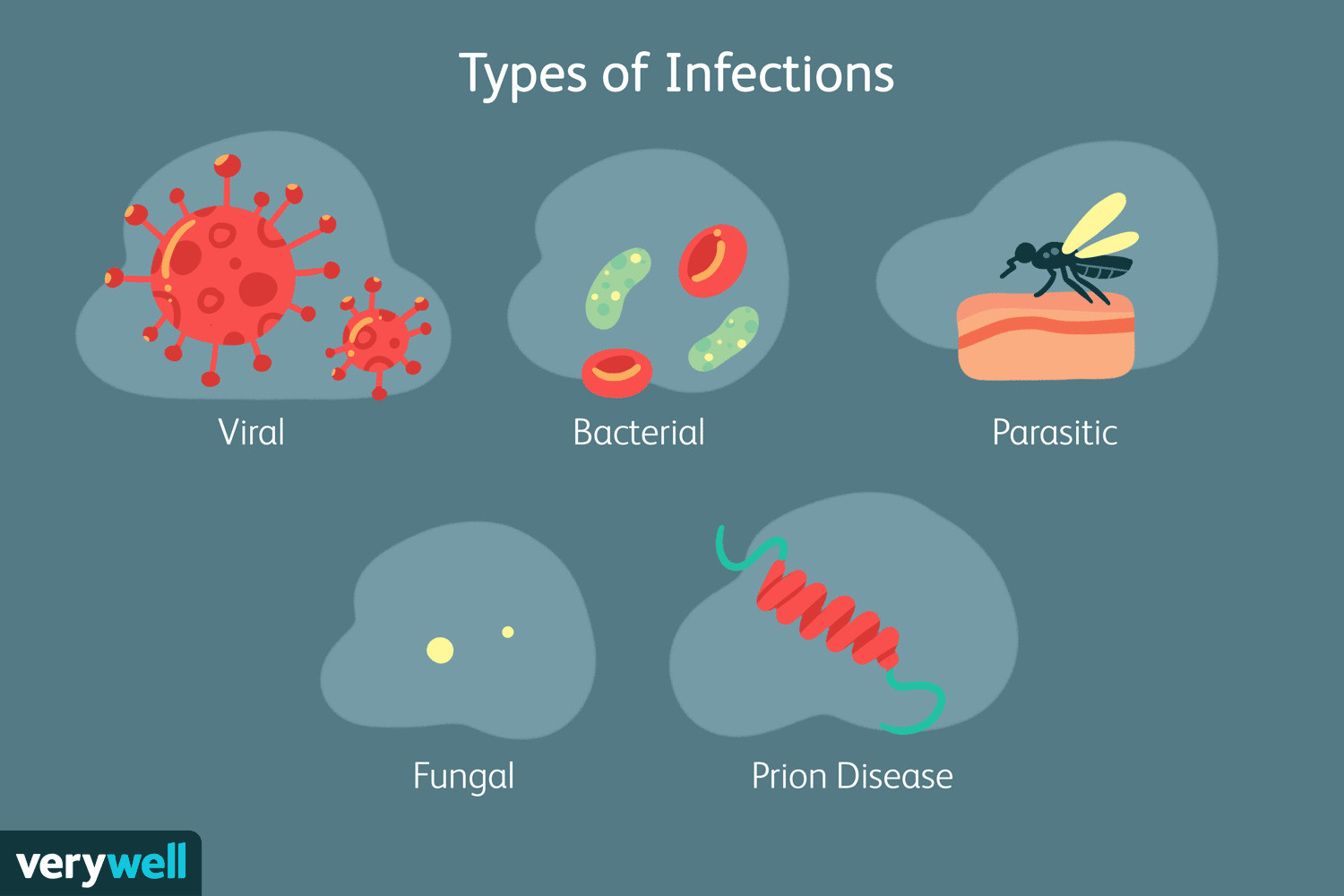 Fungal Infections vs. Bacterial Infections: Key Differences Explained