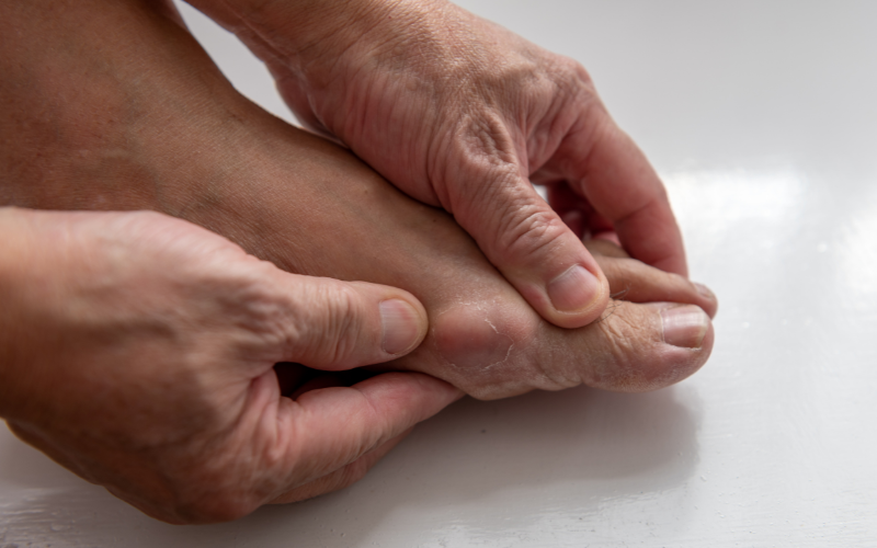 Gout in Young People: Causes and Prevention