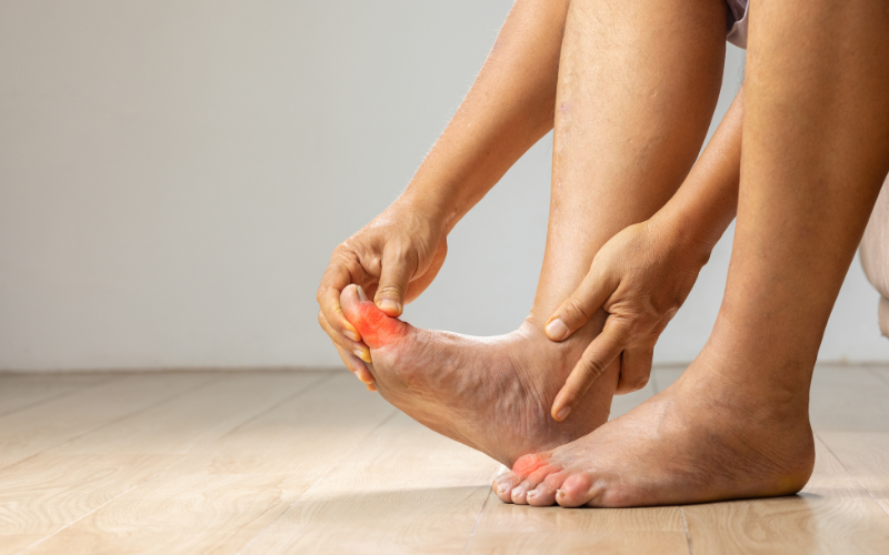 Gout vs. Arthritis: Symptoms and How to Distinguish Them